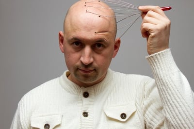 Ein Mann gibt sich selbst eine Kopfmassage gegen Haarausfall mit einem Massagegerät
