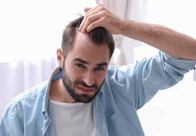 Ursachen von Haarausfall bei Männern