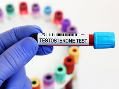 Testosteronmangel: Ursachen, Symptome, Therapie